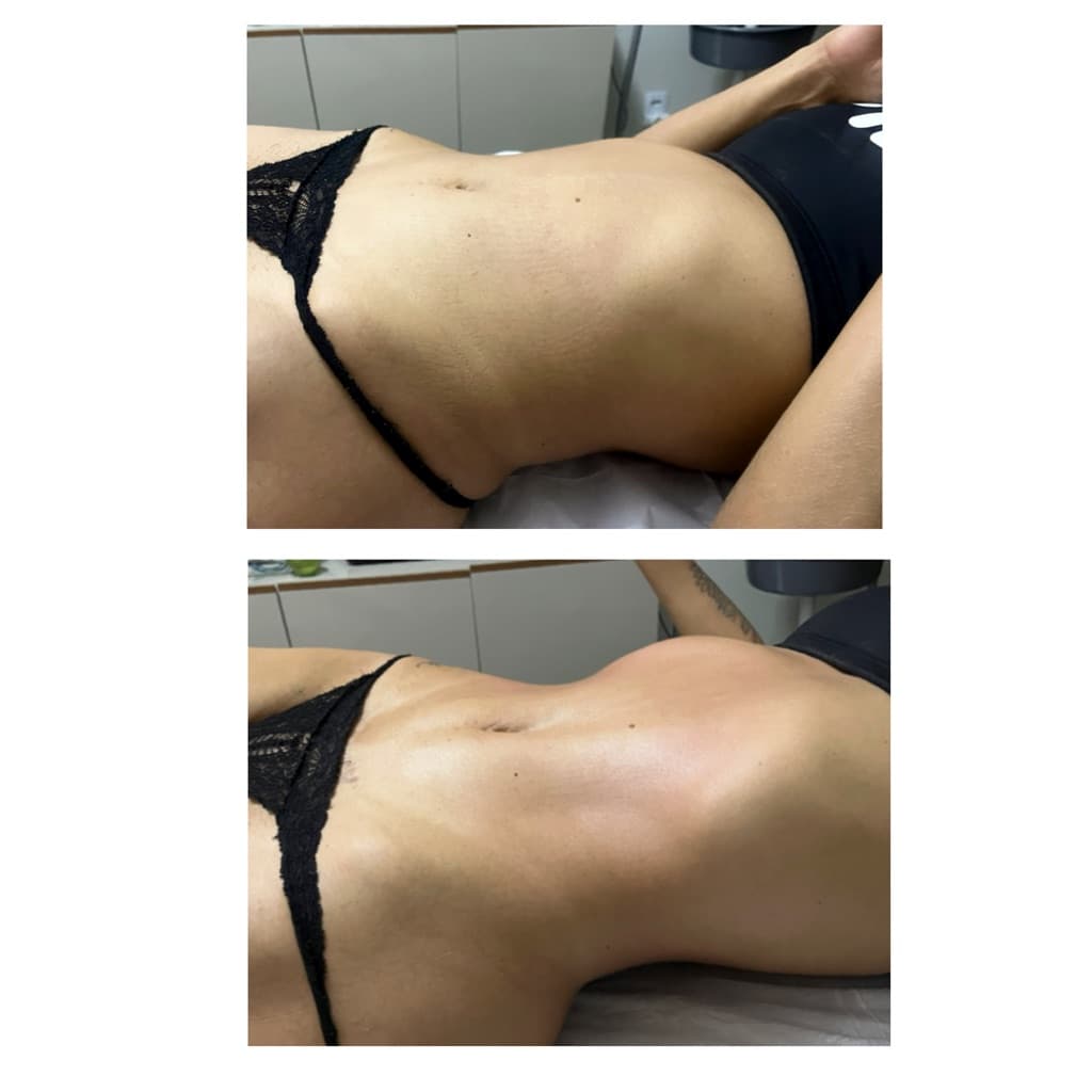 Cleane Vieira dos santos, Massagem, foto 1 de 2