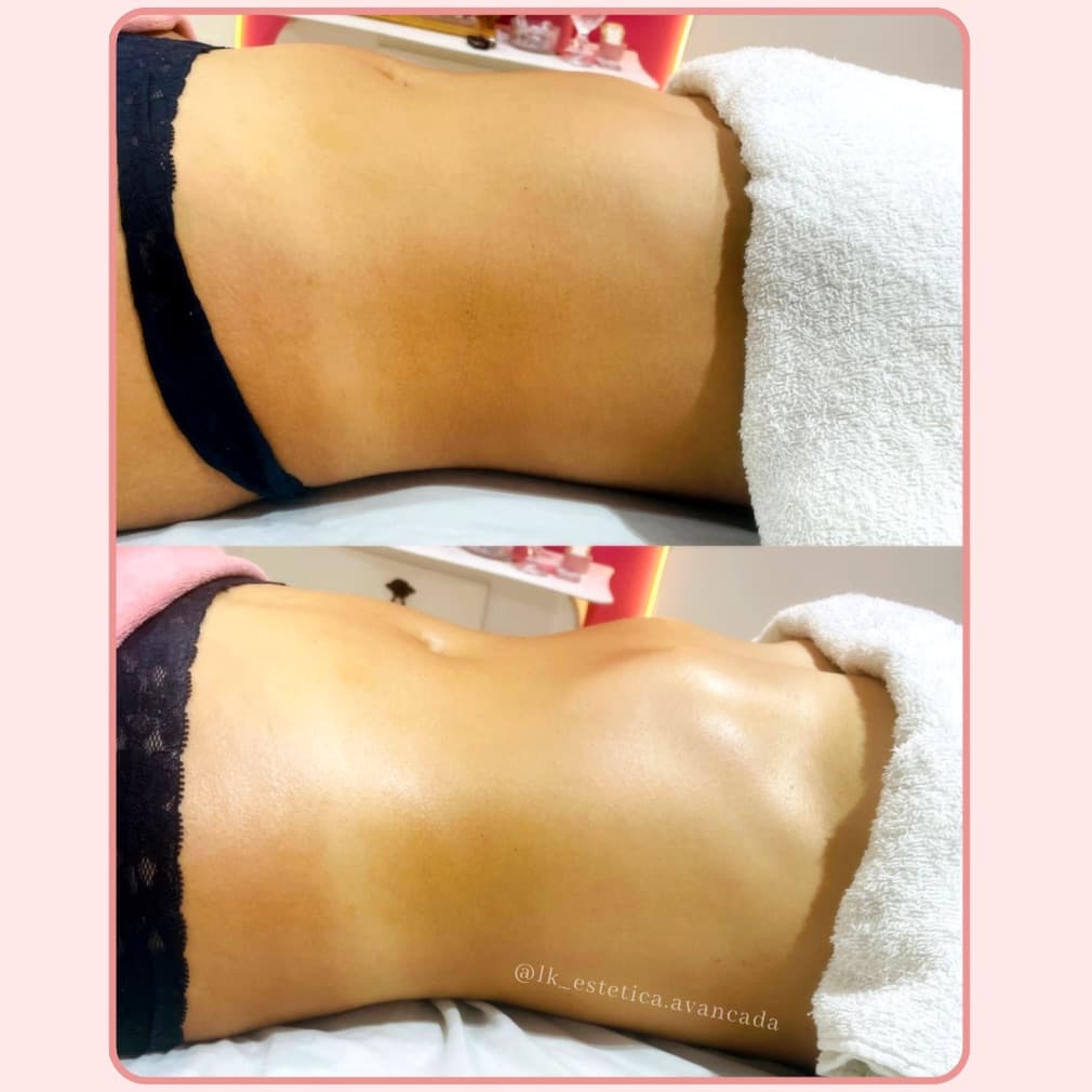 Kauane Almeida Estética, Massagem