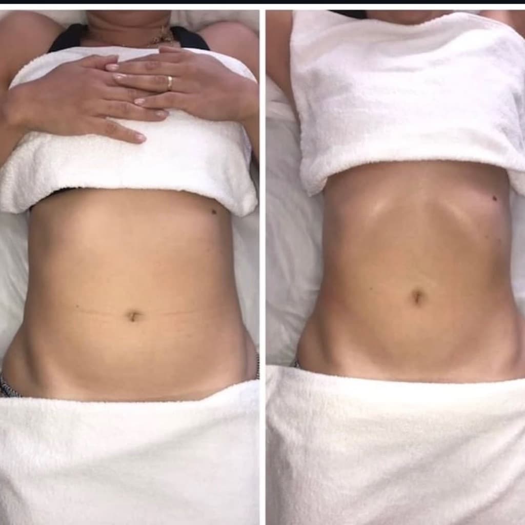 Emily Esteticista, Massagem, foto 1 de 2