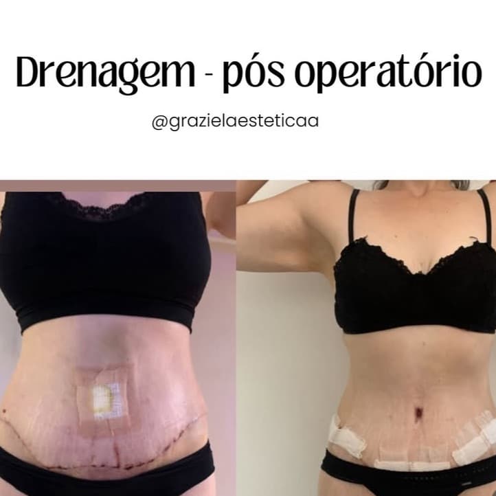Graziela Estetica, Massagem, foto 1 de 2