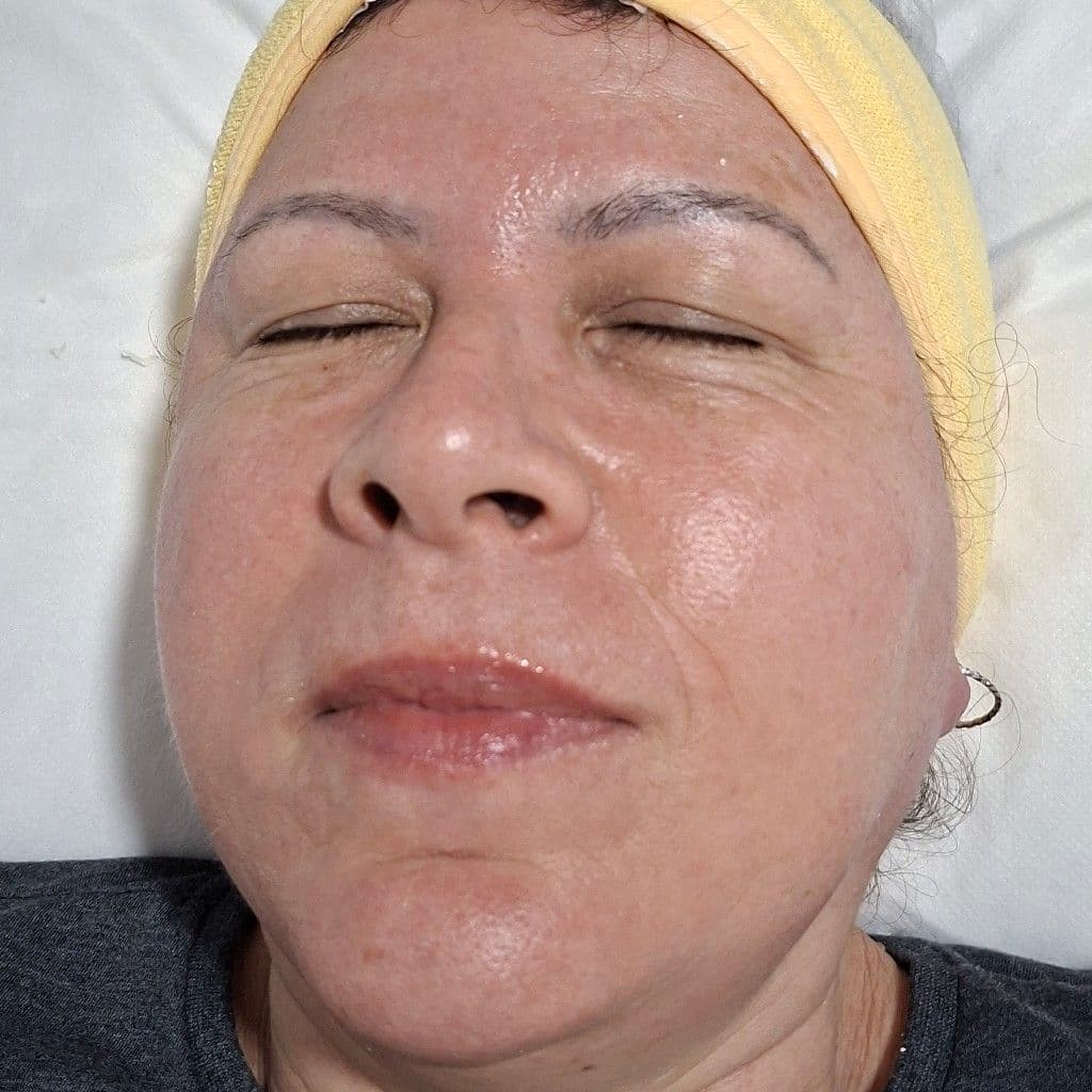 Dra. Cristiane, Pele, foto 1 de 2