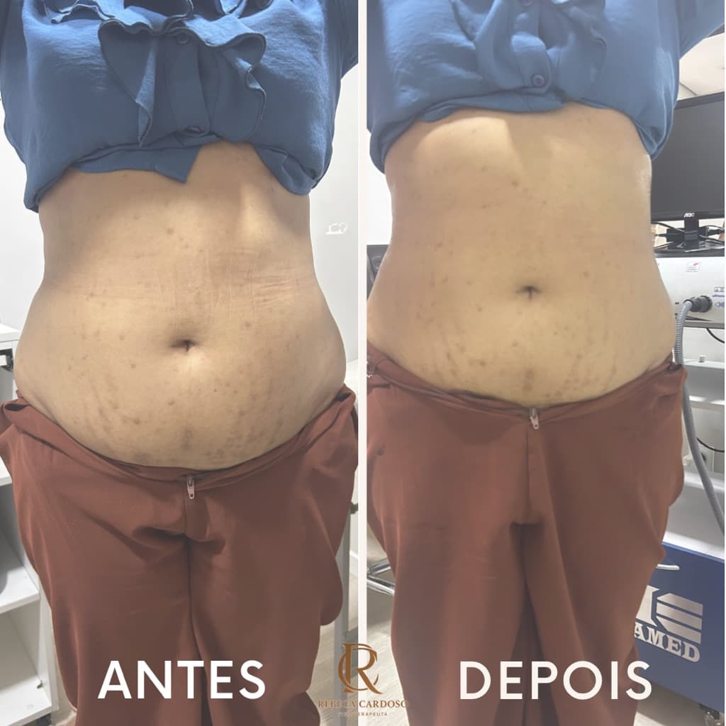 Rebeca Cardoso, Massagem, foto 1 de 2