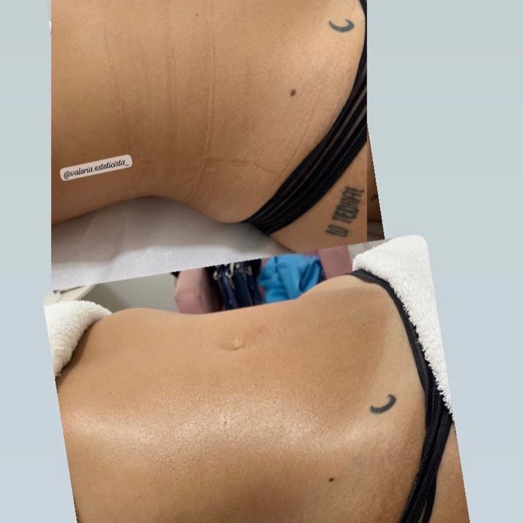 Valeria Soares, Pele, foto 1 de 2