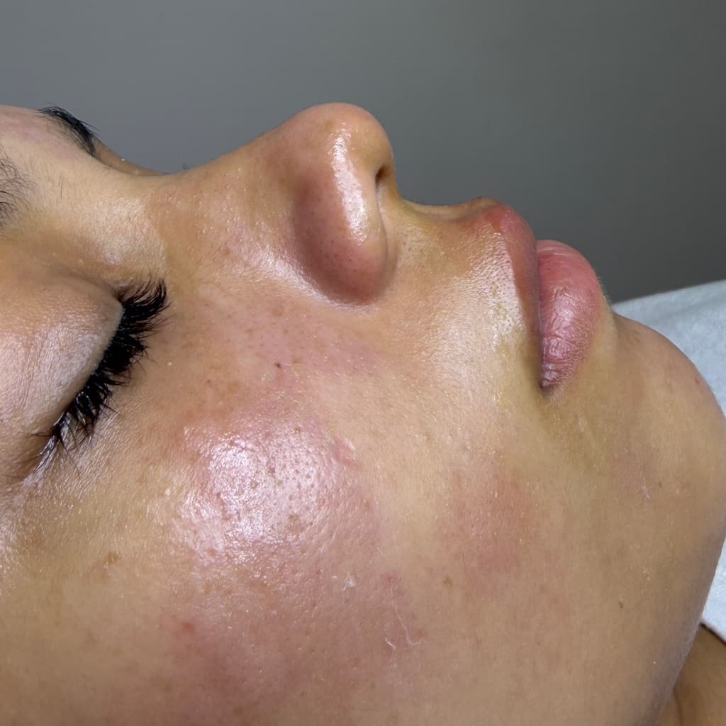 Dermax Estetica, Pele, foto 1 de 2