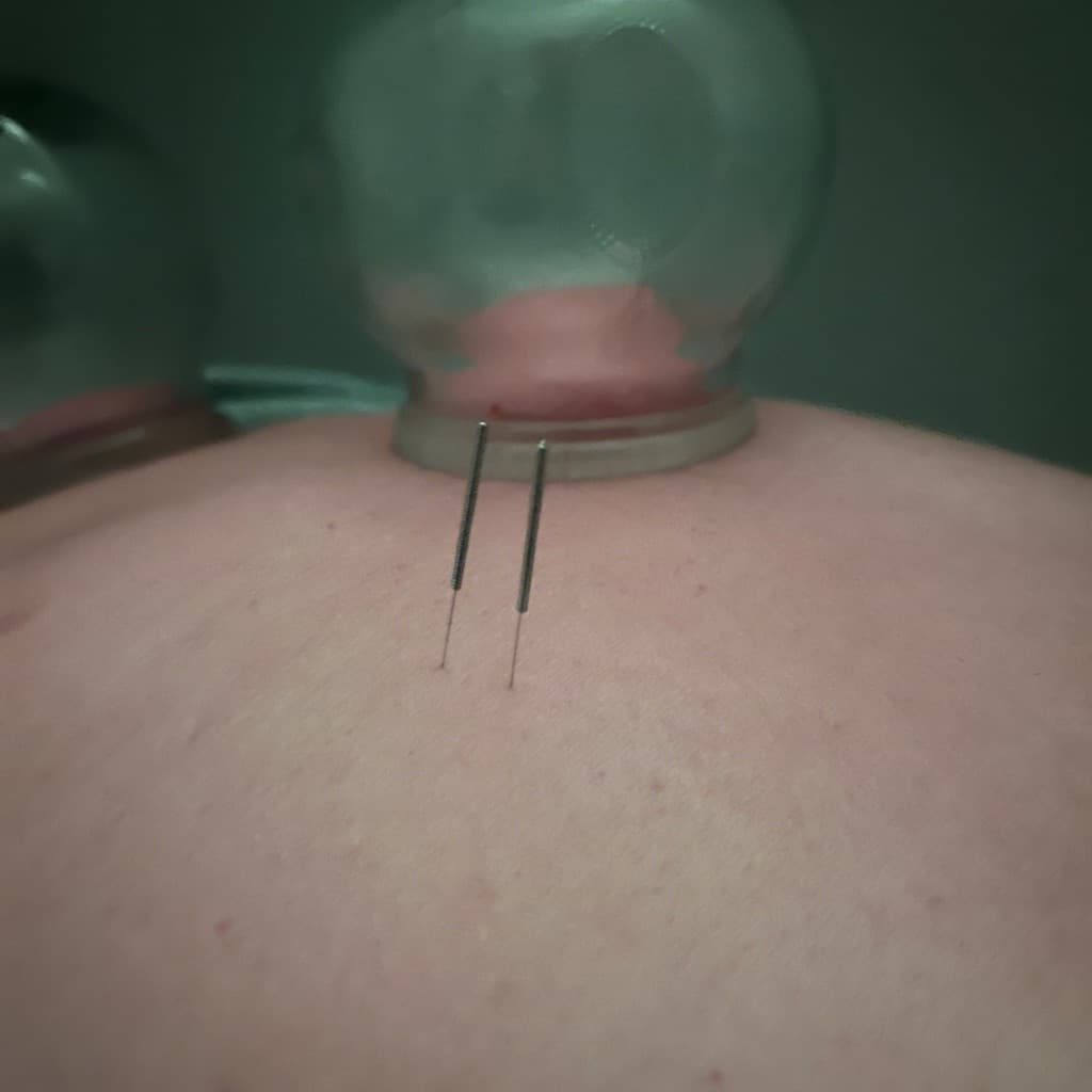 Adriano massoterapia, Massagem, foto 1 de 2