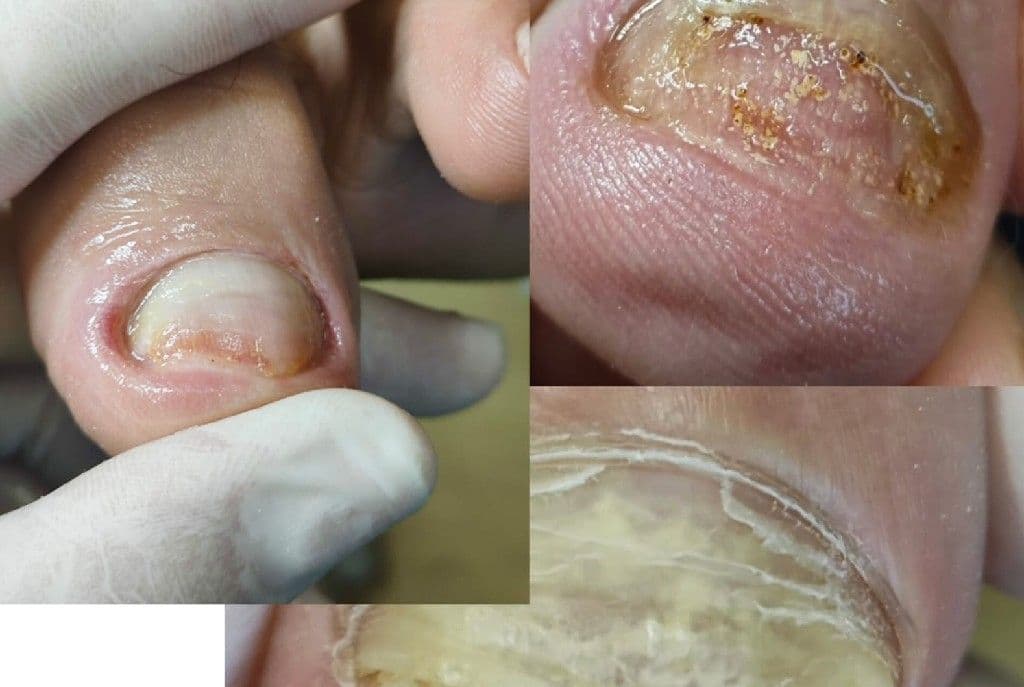 Camila Zampieri Podóloga, Unhas, foto 1 de 3