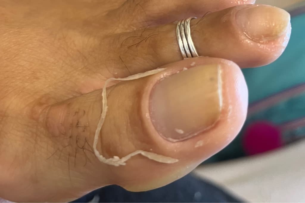 Acidalia Garcia, Unhas, foto 1 de 3