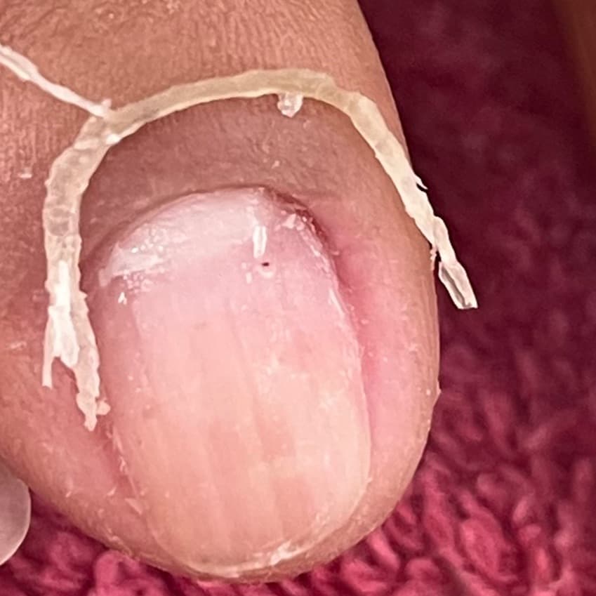 Acidalia Garcia, Unhas, foto 2 de 3
