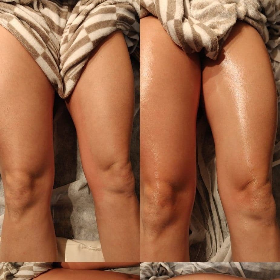 kaduhMassoterapia, Massagem, foto 1 de 1