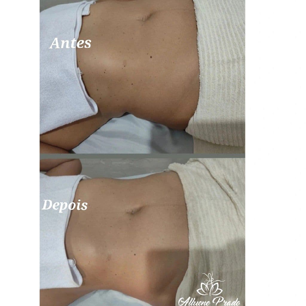 Alluene Prado, Massagem, foto 2 de 3