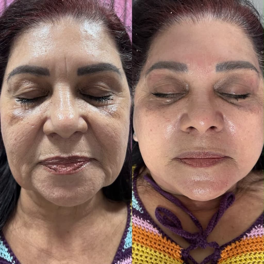 Cassia, Massagem, foto 2 de 3