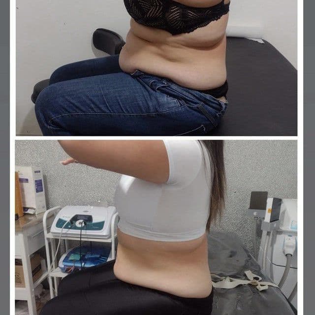 Ozonbella, Recuperação, foto 1 de 2