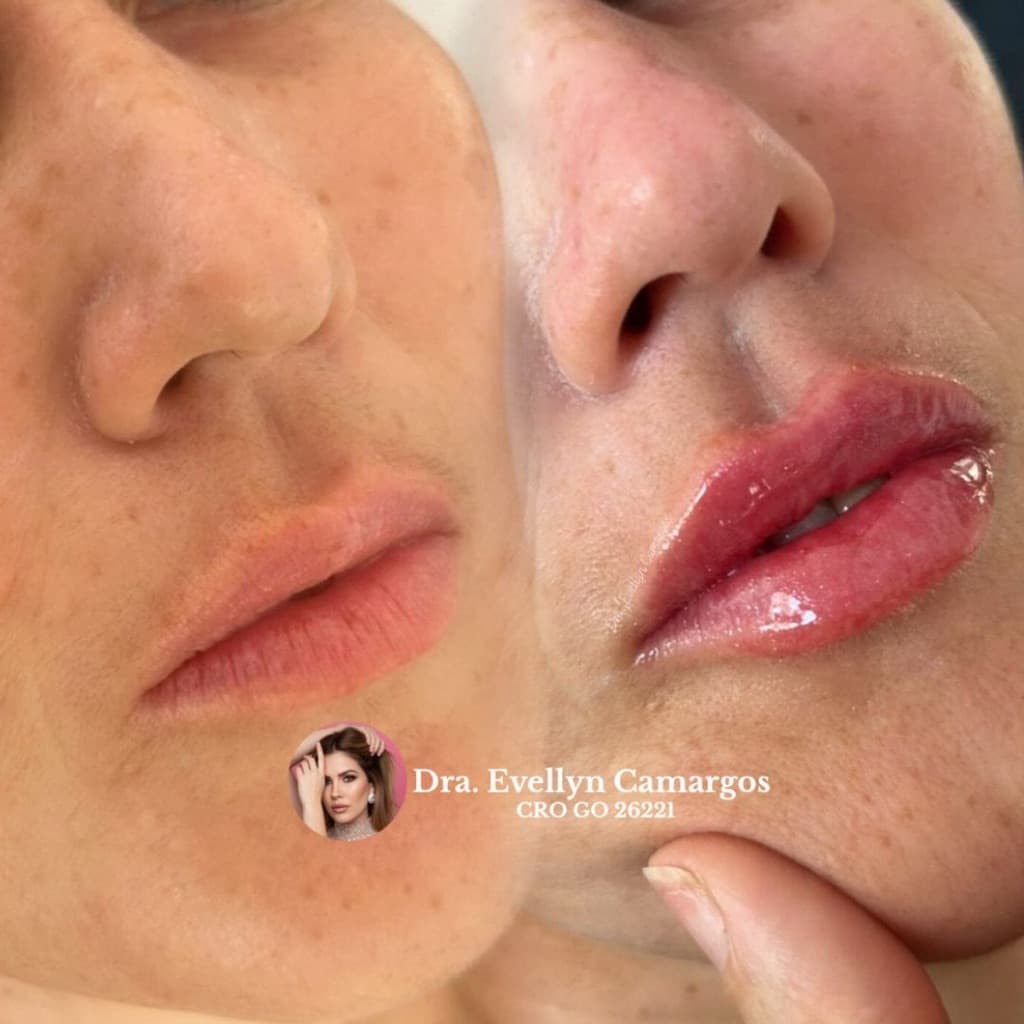 Dra Evellyn Camargos, Pele, foto 1 de 2