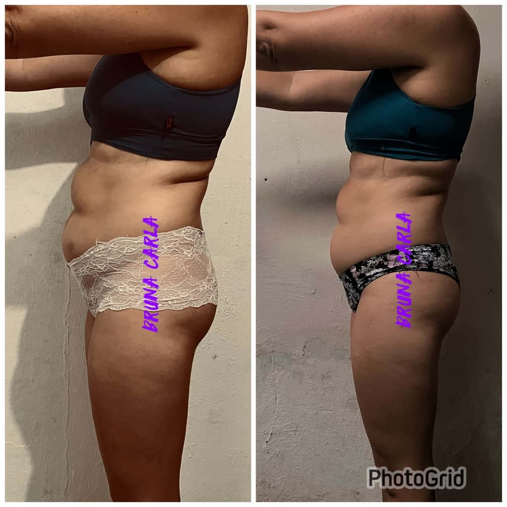 Renovalt, Massagem, foto 1 de 2