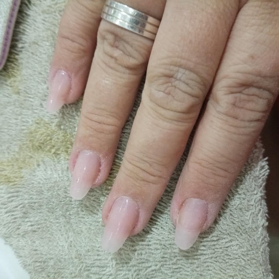 Stephanie, Unhas, foto 1 de 1