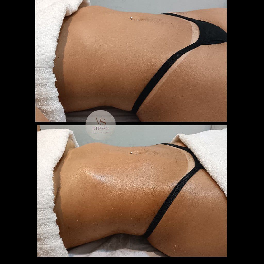 VSTulipas, Massagem, foto 2 de 3