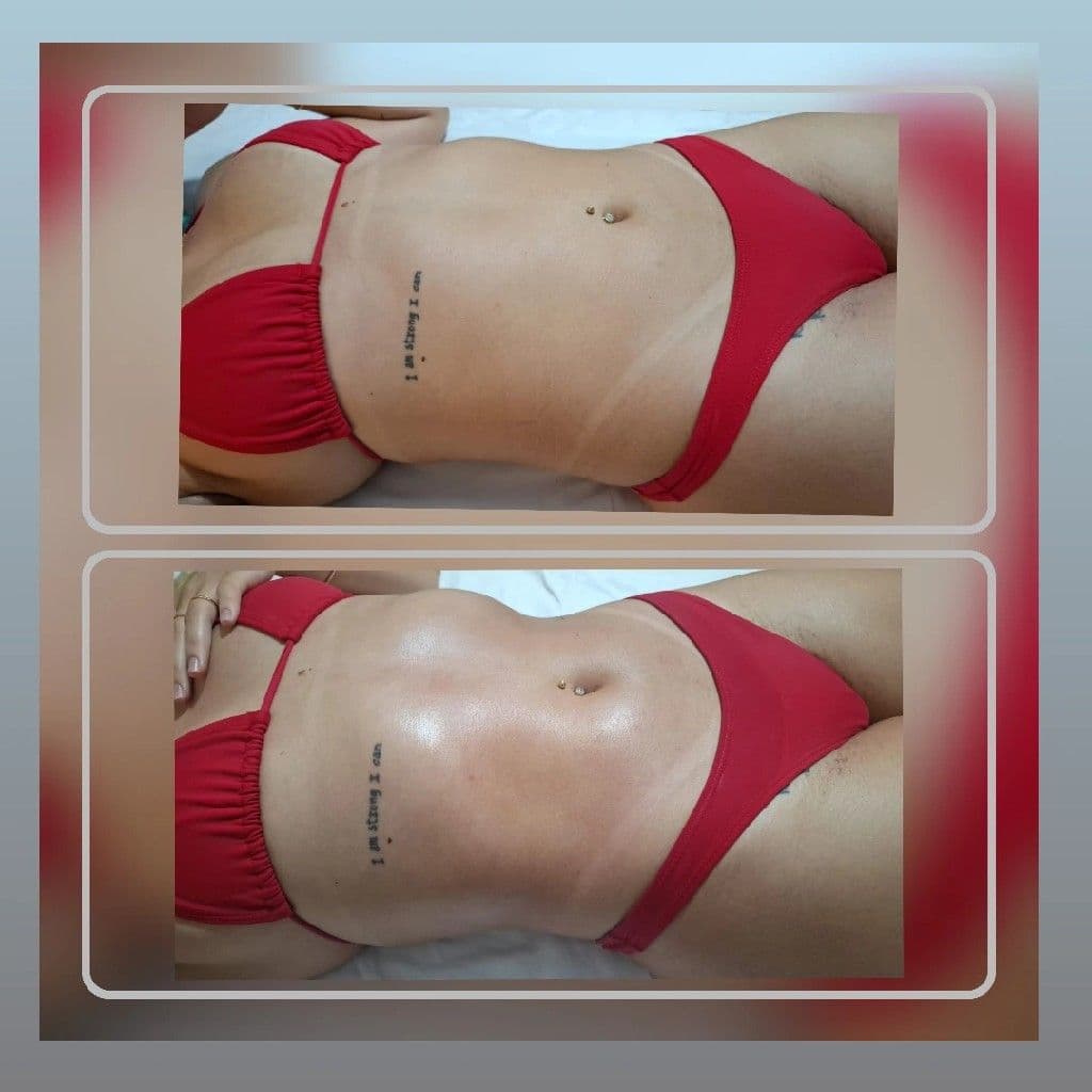 Thaisborges-estetica, Massagem