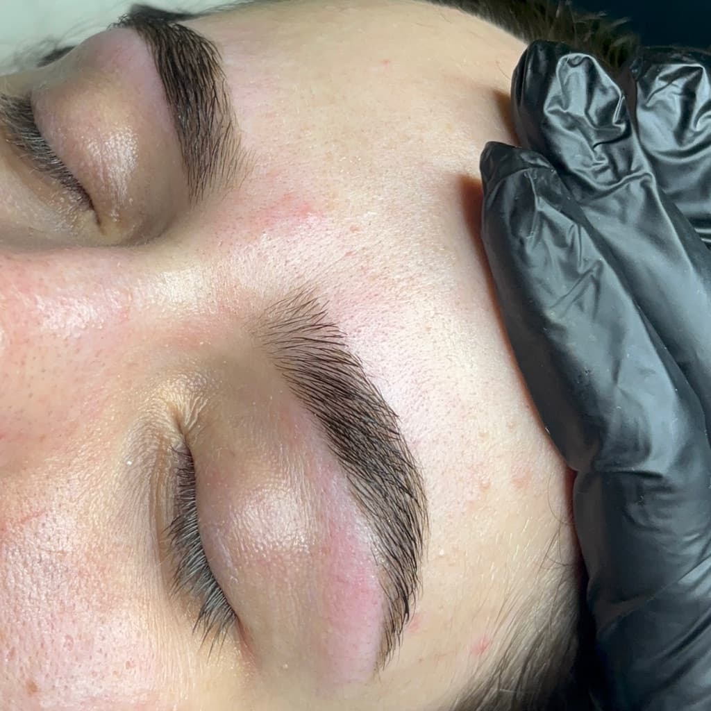 Ib Beauty Clinic, Pele, foto 2 de 6