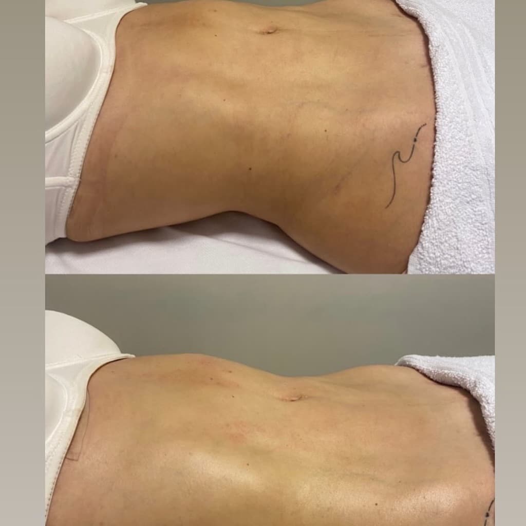 Adriele Araújo, Massagem, foto 2 de 3