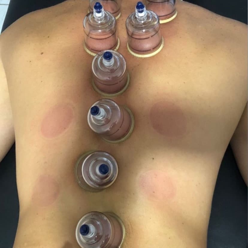 Lucas Barboza - Fisioterapeuta, Massagem, foto 2 de 3