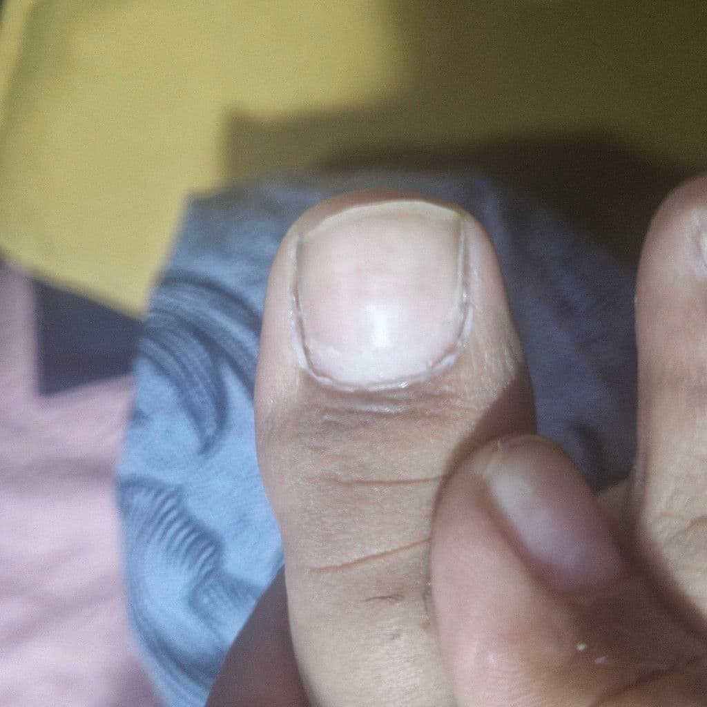 Thaynara, Unhas, foto 1 de 1