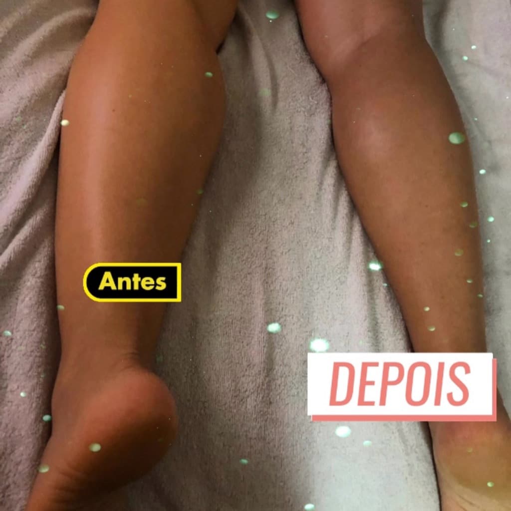 Sissa Resende, Pele, foto 1 de 1