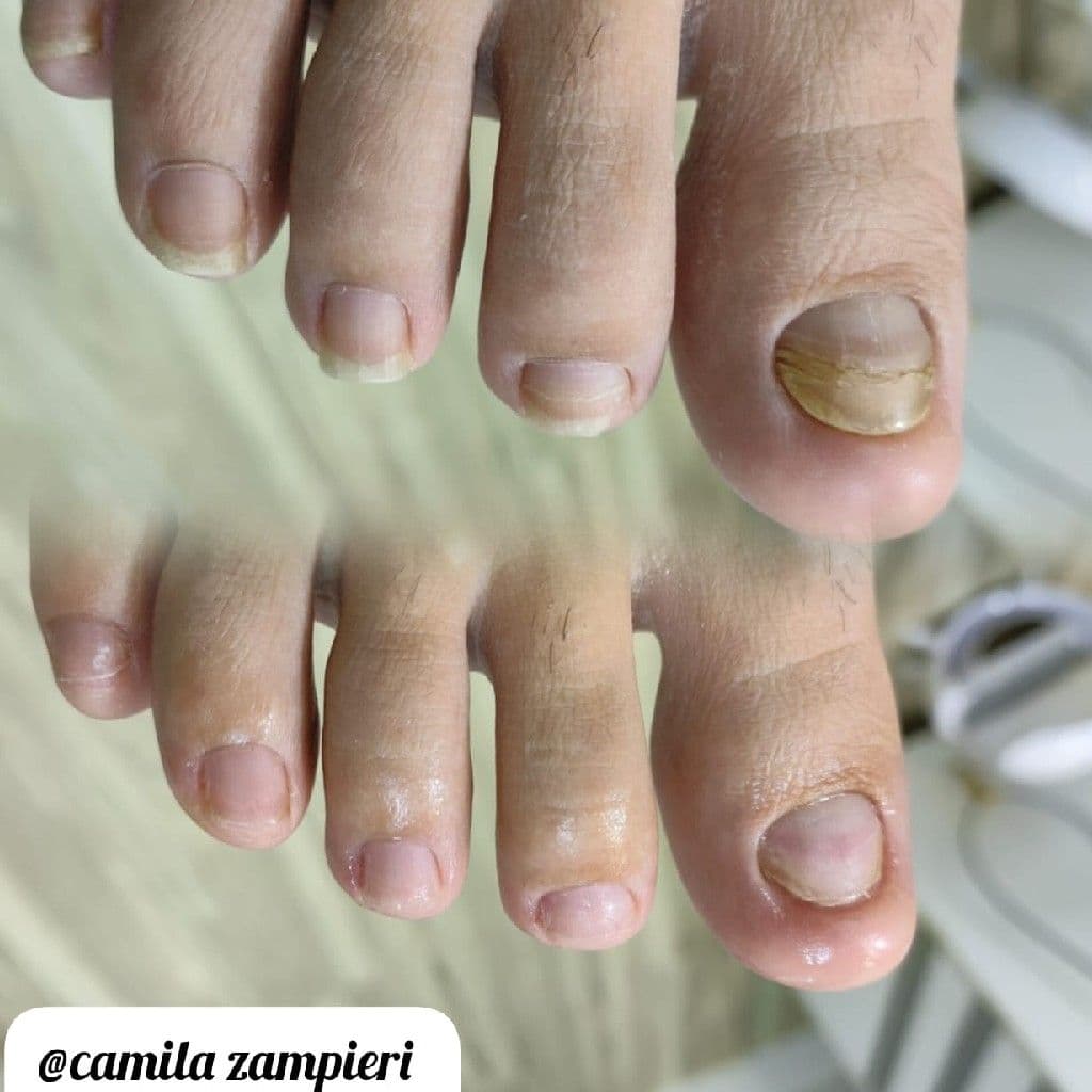 Camila Zampieri Podóloga, Unhas, foto 2 de 3
