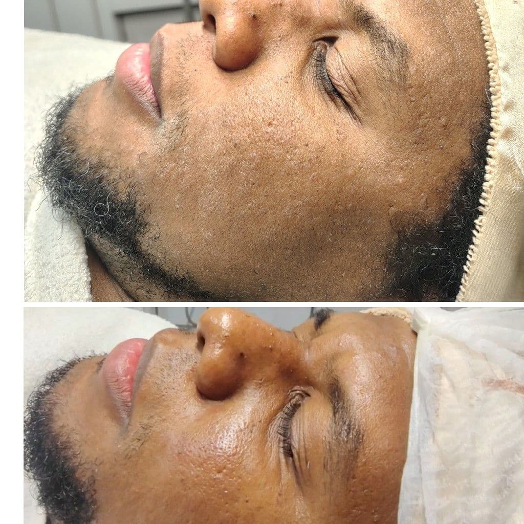 Anna Estética E Bem Estar - Limpeza De Pele 100,00, Pele, foto 2 de 8