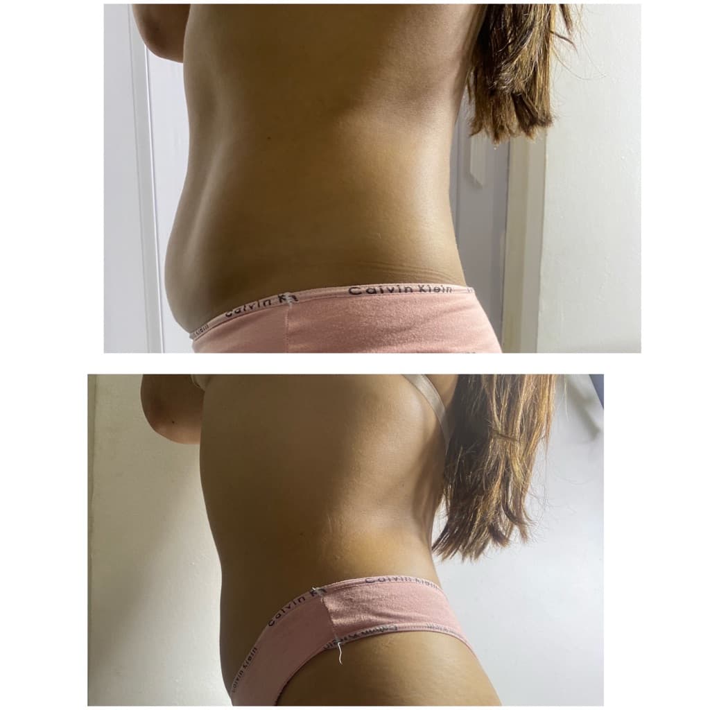 Rosana Ribeiro, Massagem, foto 1 de 2