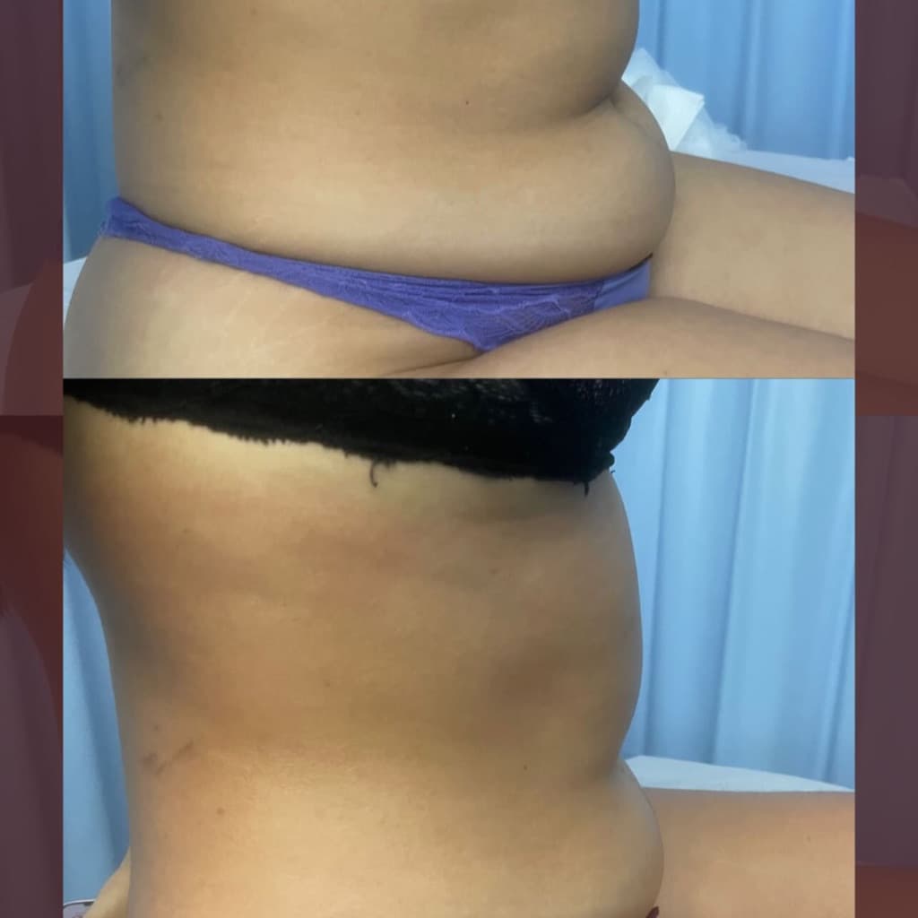 Beatriz Mendonça, Massagem, foto 2 de 3