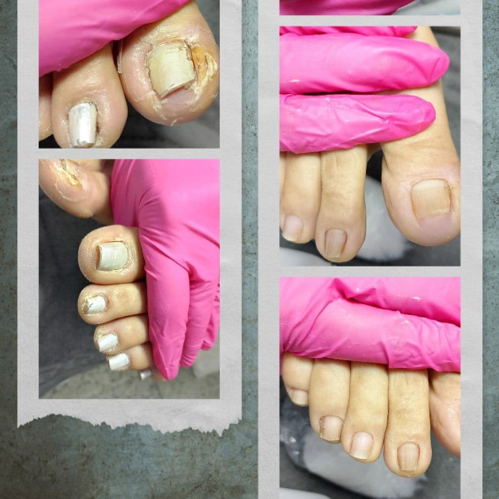 Flor, Unhas, foto 1 de 1