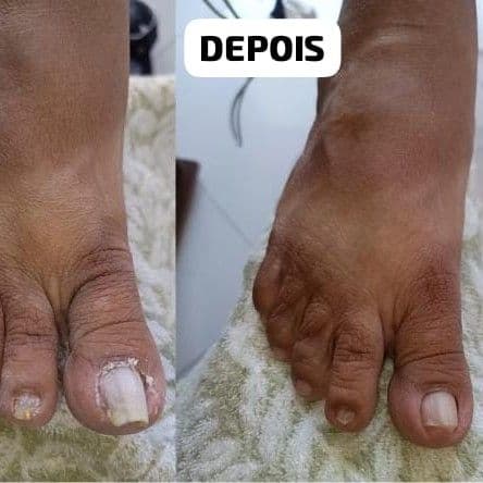 Lucinha Podologa, Recuperação, foto 2 de 3