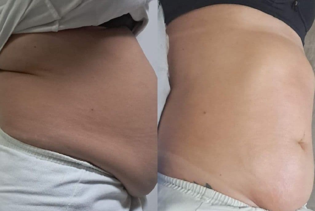 Dalila Massagem, Massagem, foto 1 de 3