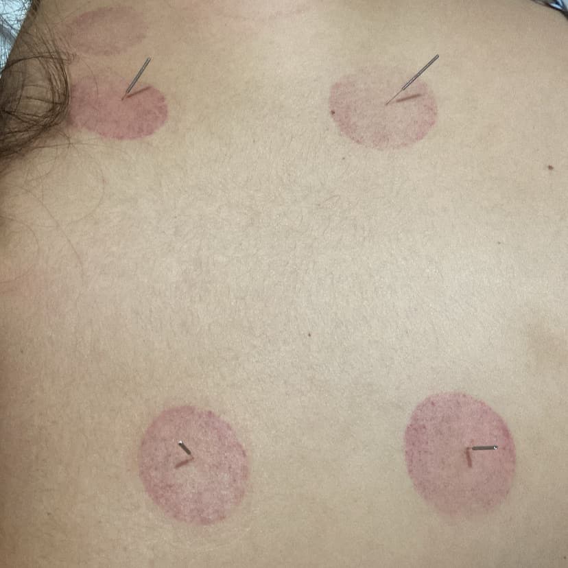 Nikollas, Massagem, foto 1 de 2