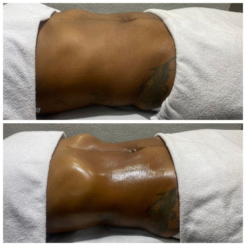 Raquel Avelino Esteticista | Método Renata França, Massagem, foto 1 de 2