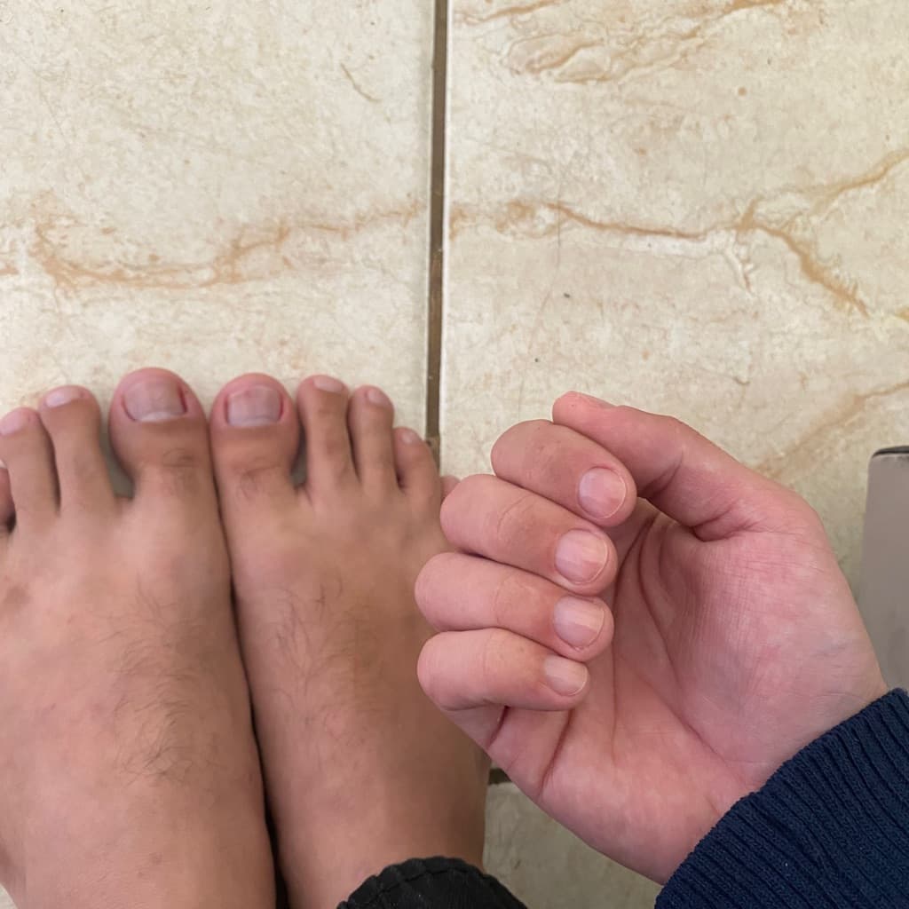 Larissa Assis, Unhas, foto 1 de 1