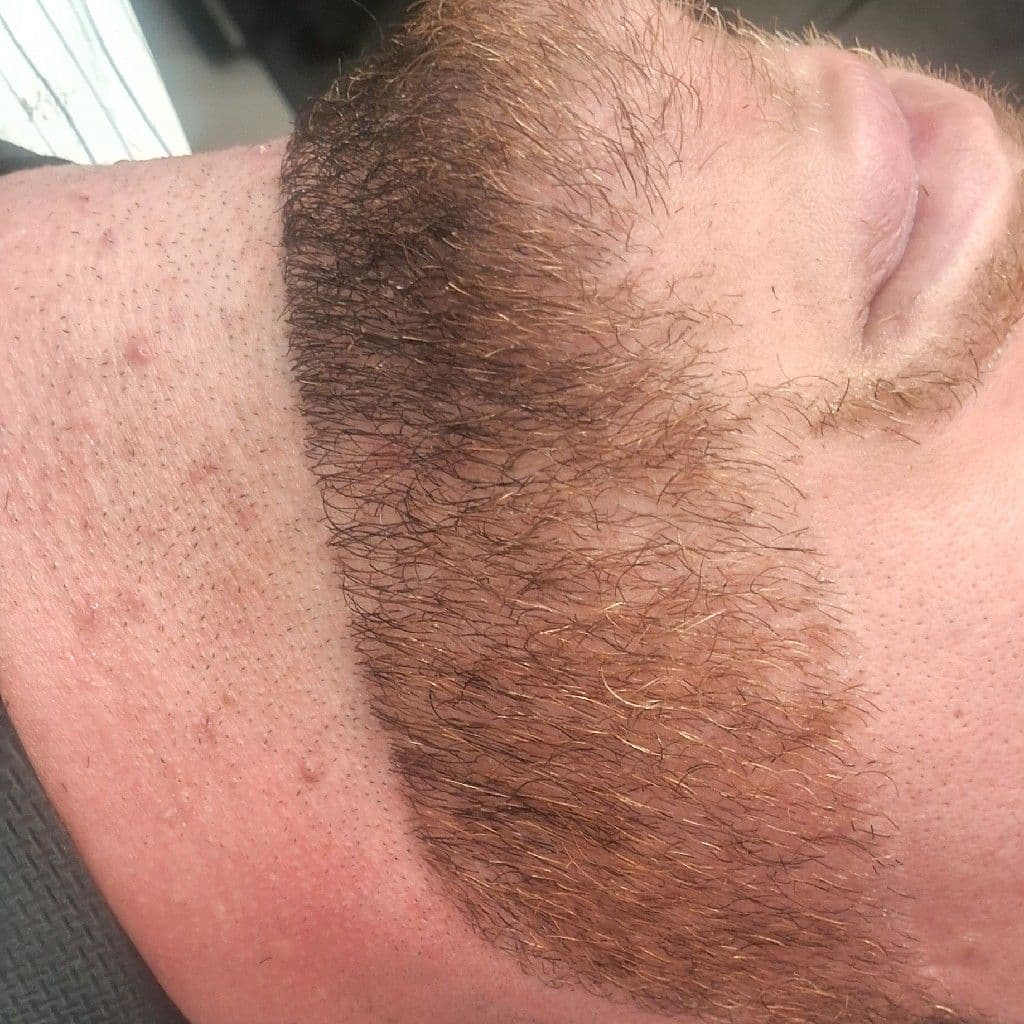 Noel, Cabelo, foto 2 de 6