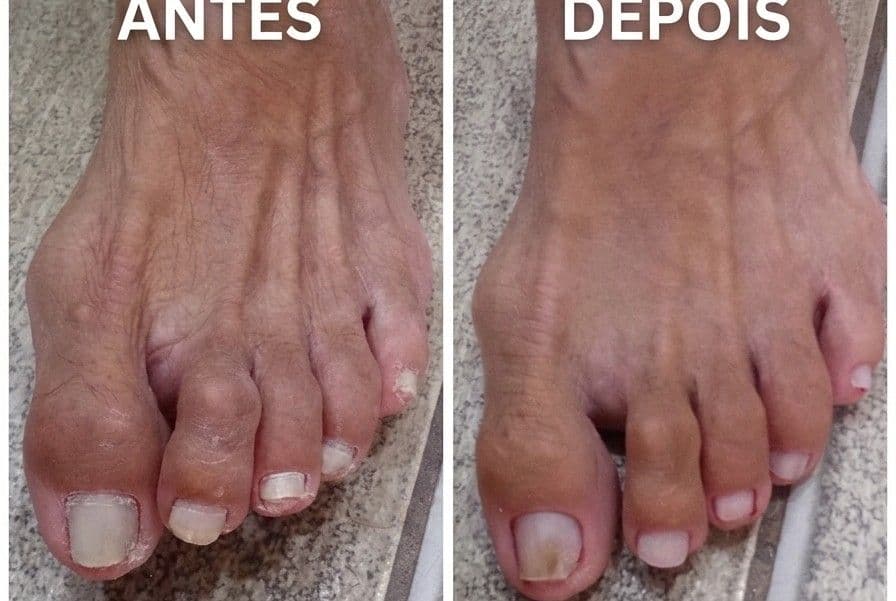 Joyce Salles, Unhas, foto 1 de 2