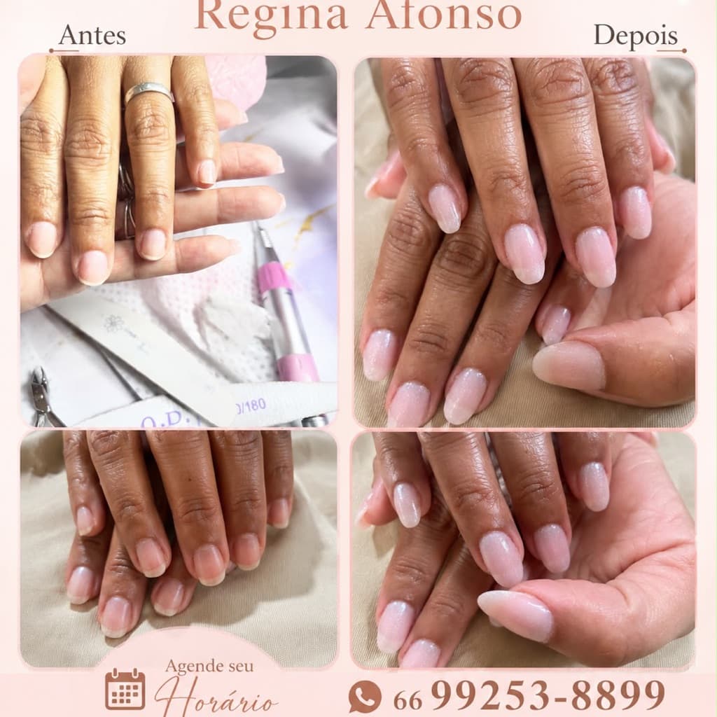 Ana regina Afonso de araujo, Unhas