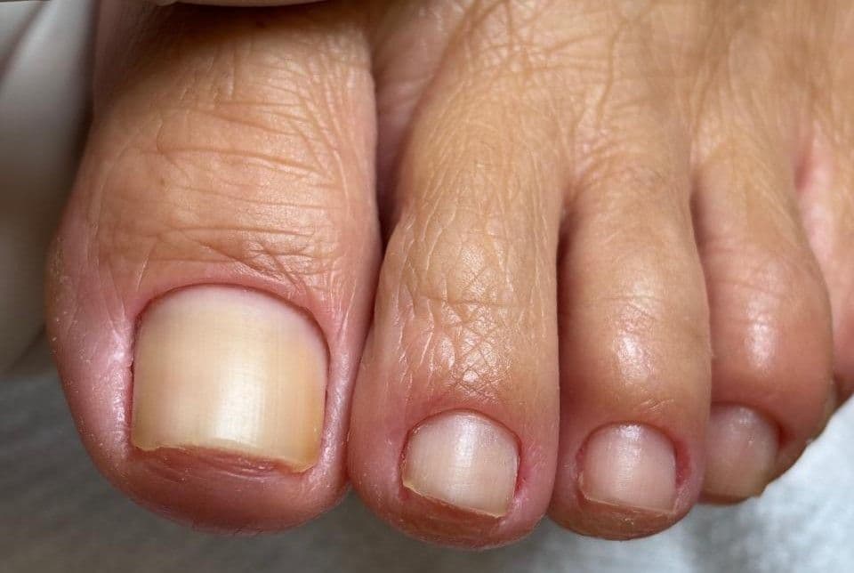 Marcela Oliveira, Unhas, foto 1 de 3