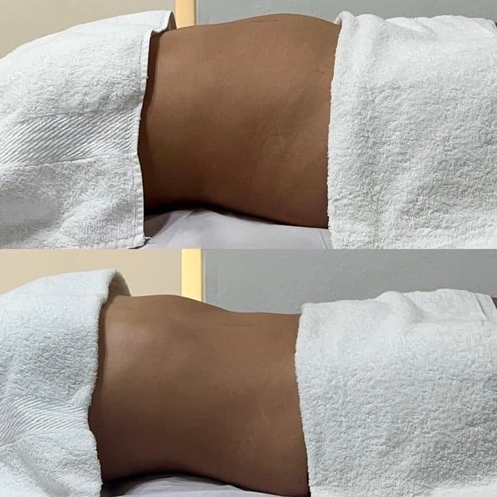 Dra Lara Isabella, Massagem