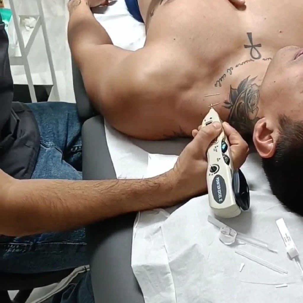 Acupuntura, Spa Asiático., Massagem, foto 2 de 3
