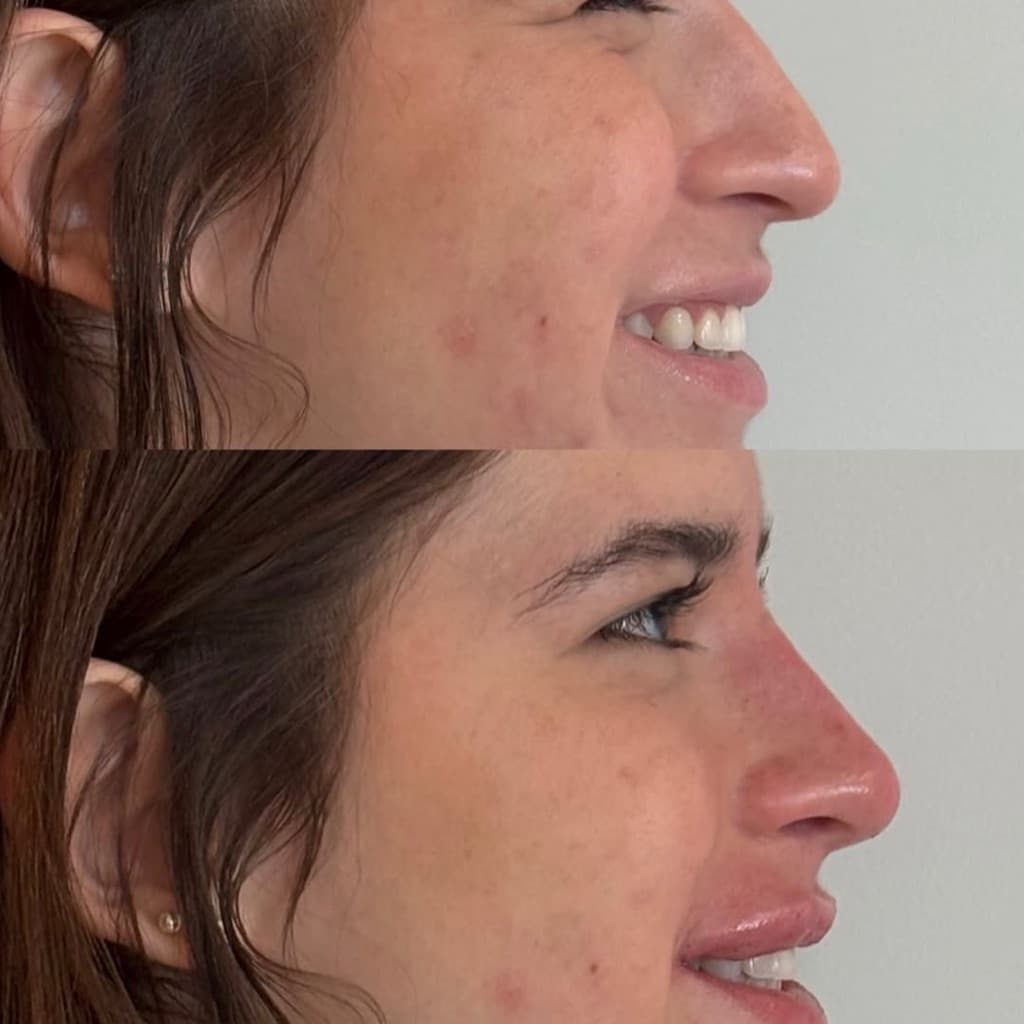 Acelo Lambrini Argento, Massagem, foto 1 de 1