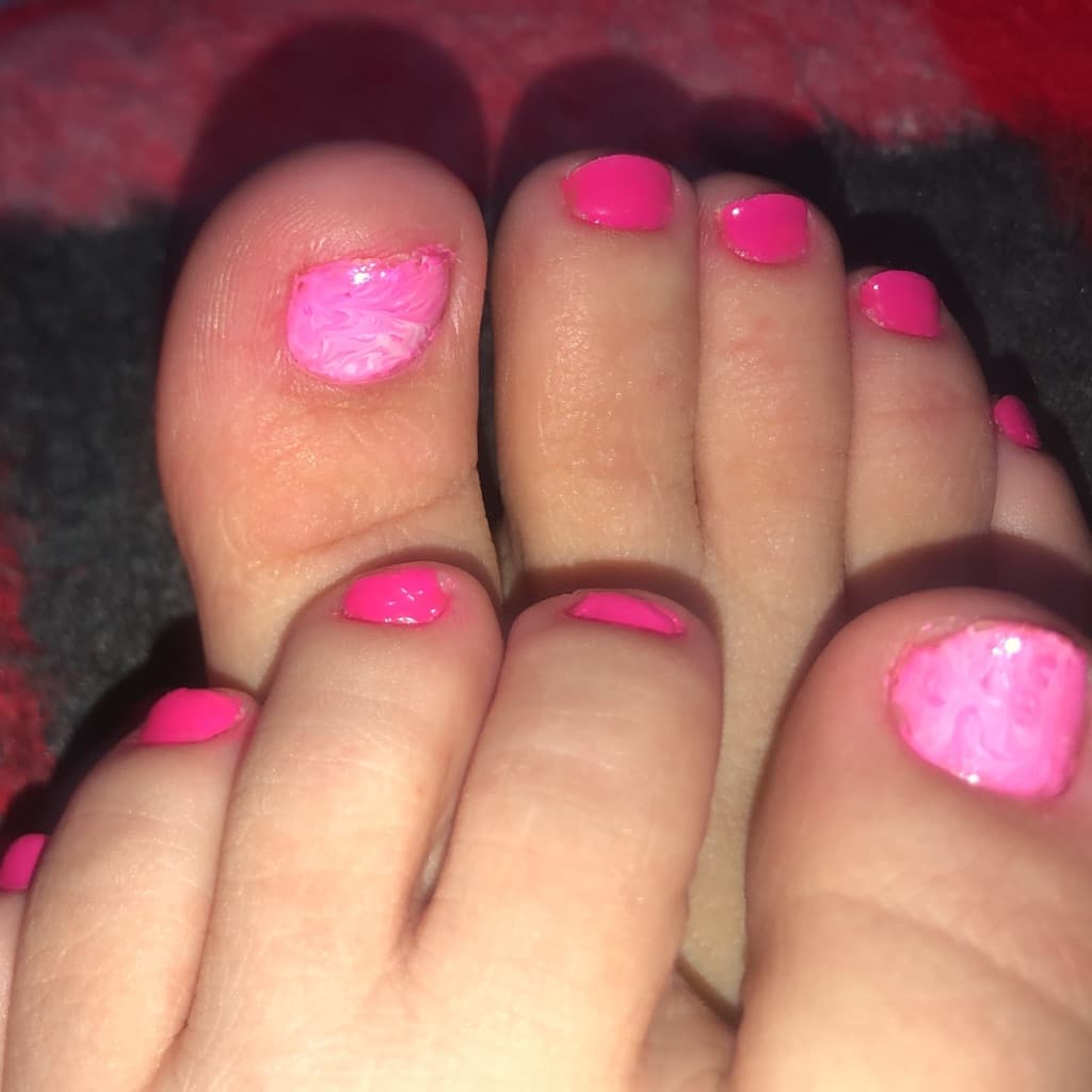 Erika, Unhas