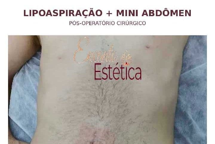 Roberlandia (Encanto Estética), Pele