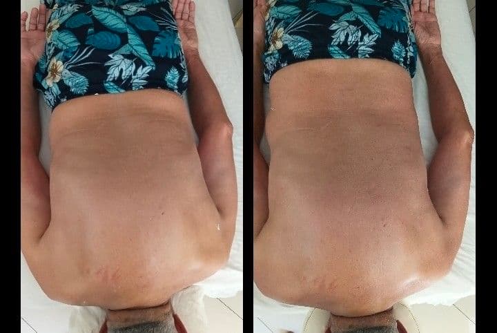 Aninha Massoterapeuta, Massagem, foto 1 de 3
