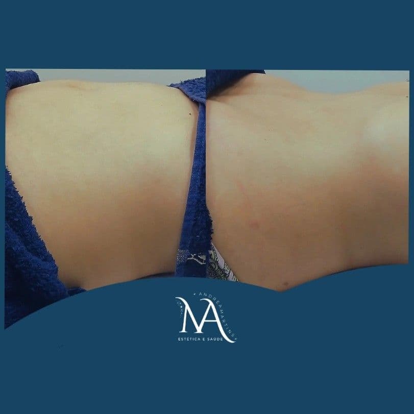 Andrea Martins, Massagem, foto 2 de 3