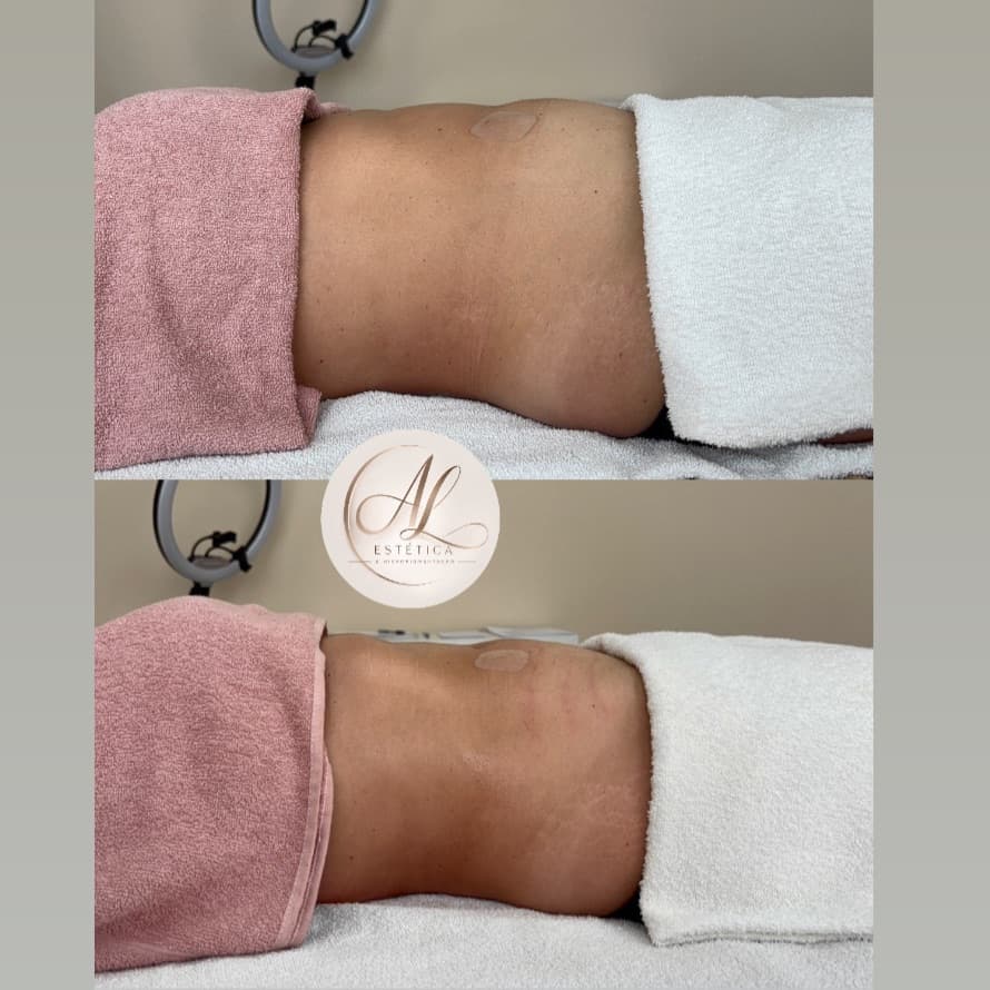 Ariane Laines Estetica /Micropigmentação/Epilaçao, Massagem, foto 2 de 7