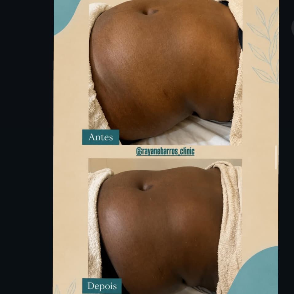 Rayane Barros Clinic, Massagem, foto 1 de 2