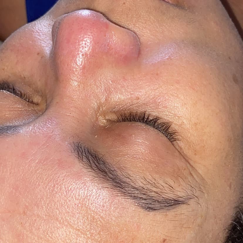 Esteticista Marina Rocha, Pele